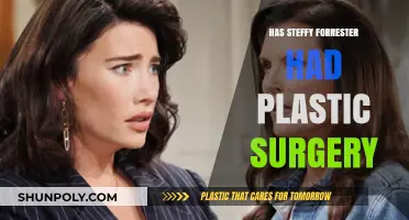 Steffy Forrester's Transformation: Plastic Surgery Speculations and Truths