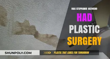 Stephanie Acevedo's Transformation: Plastic Surgery Speculations and Truths Revealed