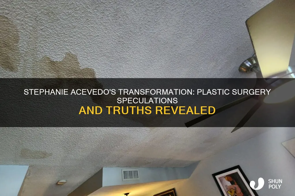has stephanie acevedo had plastic surgery