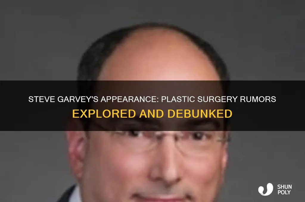 has steve garvey had plastic surgery