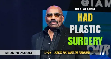 Steve Harvey's Transformation: Plastic Surgery Rumors Explored and Debunked