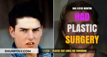 Steve Martin's Appearance: Plastic Surgery Rumors Explored and Debated