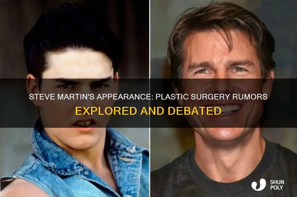 has steve martin had plastic surgery