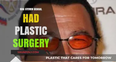 Steven Seagal's Transformation: Plastic Surgery Rumors and Reality