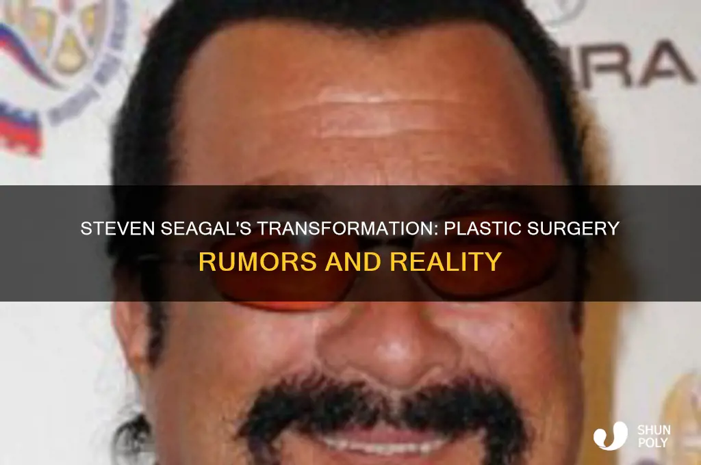 has steven seagal had plastic surgery