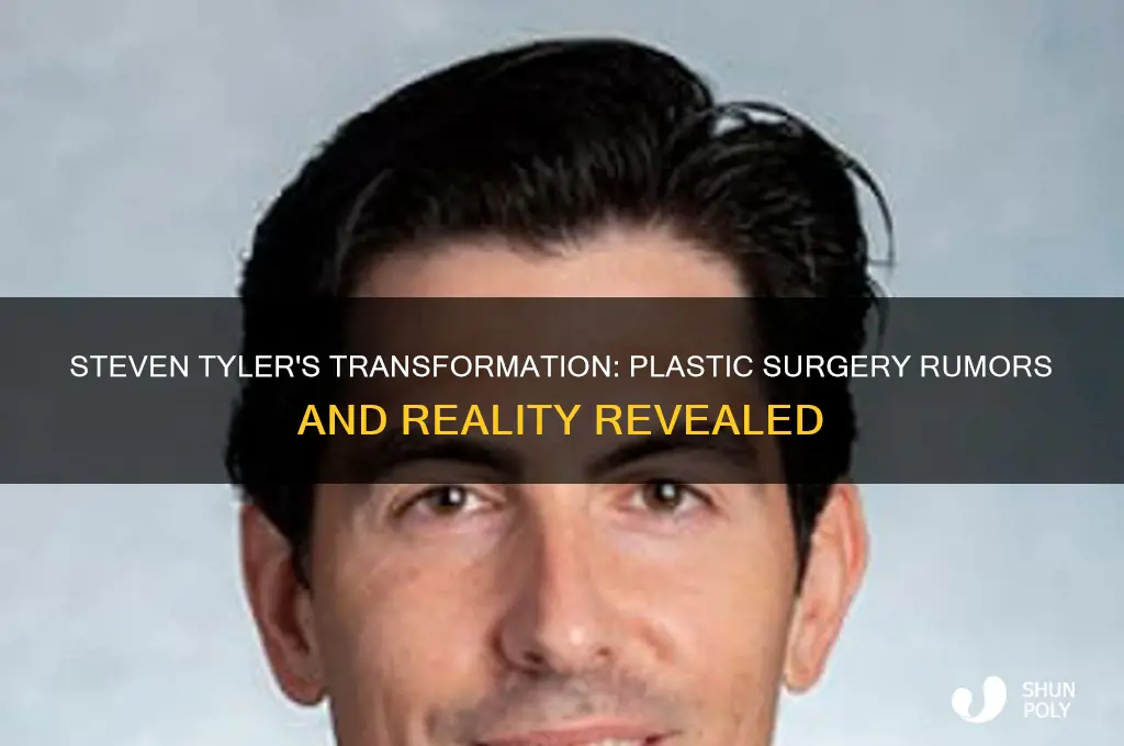 has steven tyler had plastic surgery