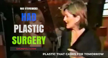 Stevie Nicks Plastic Surgery: Fact-Checking the Rumors and Speculations