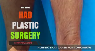 Has Sting Had Plastic Surgery? Unveiling the Truth Behind His Youthful Look