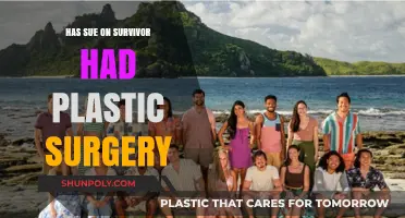 Has Sue from Survivor Had Plastic Surgery? Unveiling the Truth