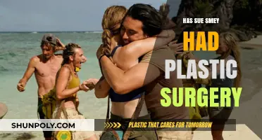 Has Sue Smey Had Plastic Surgery? Unveiling the Truth