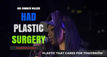 Has Summer Walker Had Plastic Surgery? Unveiling the Truth