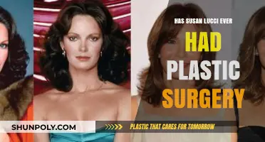 Susan Lucci's Ageless Beauty: Plastic Surgery Rumors Explored