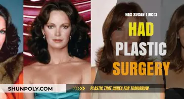 Susan Lucci's Transformation: Plastic Surgery Speculations and Truths Revealed