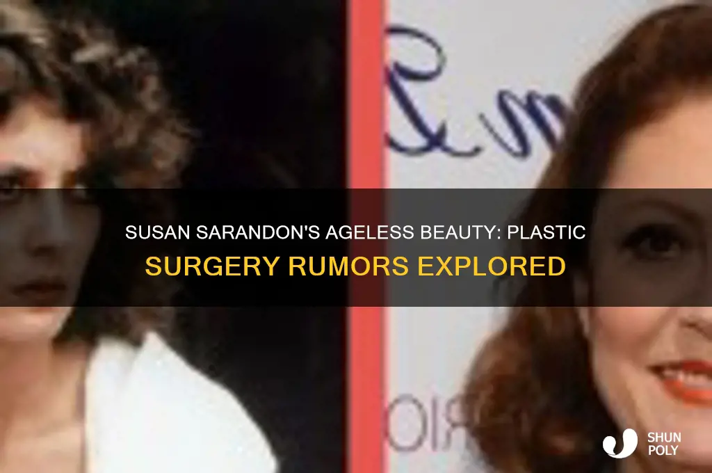 has susan sarandon had plastic surgery