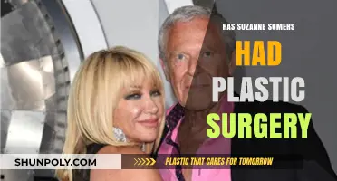 Suzanne Somers Plastic Surgery: Fact-Checking the Rumors and Speculations