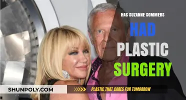 Suzanne Somers Plastic Surgery: Fact-Checking Her Ageless Appearance