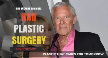 Suzanne Somers' Plastic Surgery: Fact-Checking the Rumors and Speculations