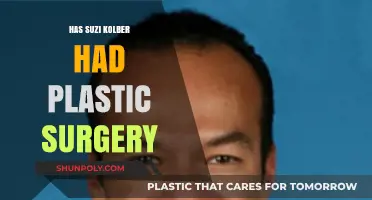 Suzi Kolber's Appearance: Plastic Surgery Speculations and Truths