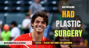 Has Svitolina Had Plastic Surgery? Uncovering the Truth Behind the Rumors