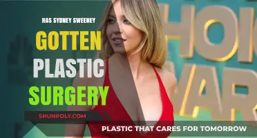 Sydney Sweeney Plastic Surgery: Fact-Checking the Rumors and Speculations