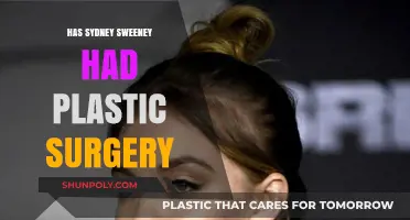 Sydney Sweeney's Transformation: Natural Beauty or Plastic Surgery?