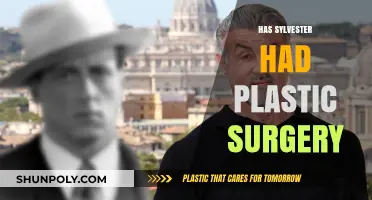 Sylvester Stallone's Transformation: Plastic Surgery Rumors and Reality