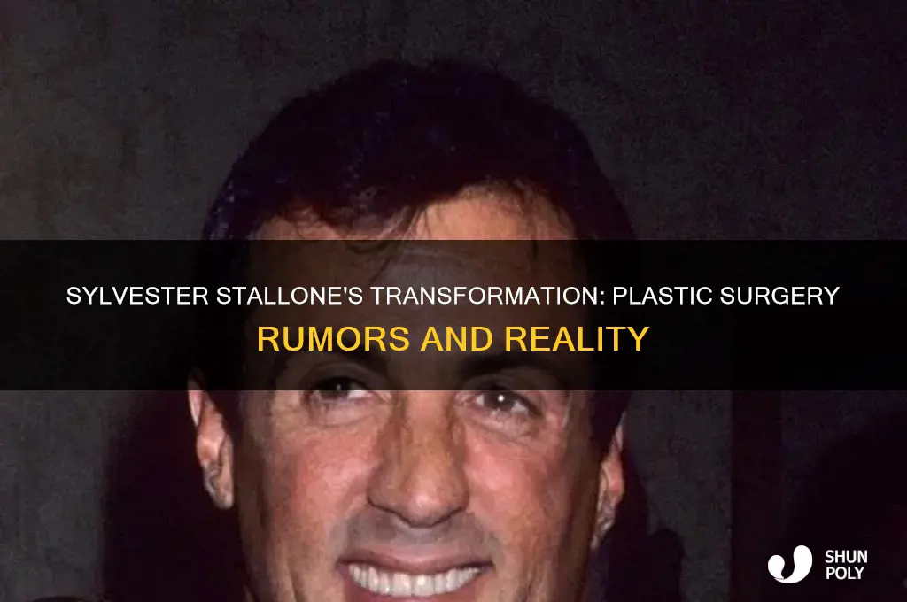 has sylvester had plastic surgery