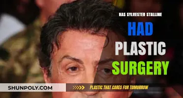 Sylvester Stallone's Transformation: Plastic Surgery Rumors Explored