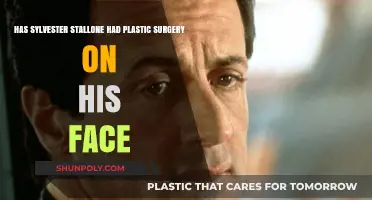 Sylvester Stallone's Face: Plastic Surgery Rumors Explored