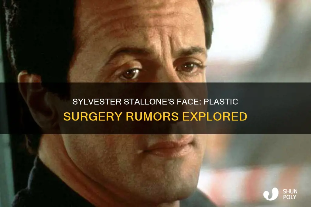 has sylvester stallone had plastic surgery on his face