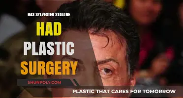 Sylvester Stallone's Transformation: Plastic Surgery Rumors and Reality