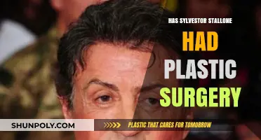 Sylvester Stallone's Transformation: Plastic Surgery Rumors and Reality