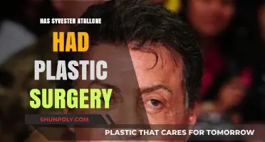 Sylvester Stallone's Changing Looks: Plastic Surgery Rumors Explored