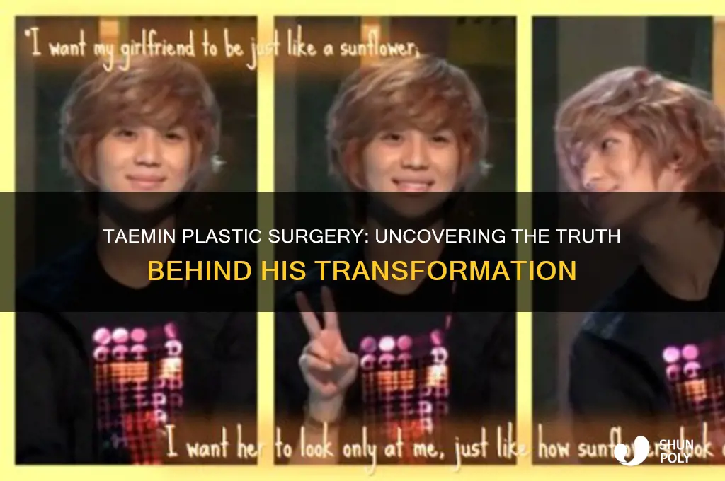 has taemin had plastic surgery