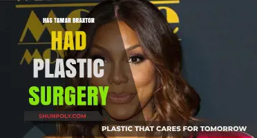 Tamar Braxton's Transformation: Plastic Surgery Rumors and Reality Revealed