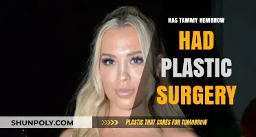 Tammy Hembrow Plastic Surgery: Fact-Checking Her Transformation Rumors