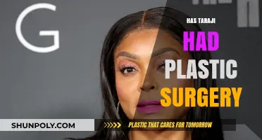 Has Taraji P. Henson Undergone Plastic Surgery? The Truth Revealed