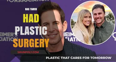 Has Tarek El Moussa Undergone Plastic Surgery? Unveiling the Truth