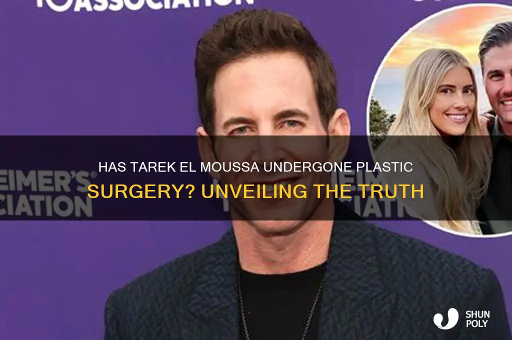 has tarek had plastic surgery
