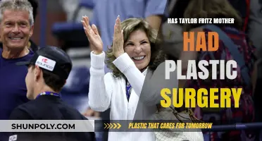 Taylor Fritz's Mom: Plastic Surgery Speculations and Truths Revealed