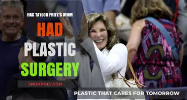 Taylor Fritz's Mom: Plastic Surgery Speculations and Truths Revealed
