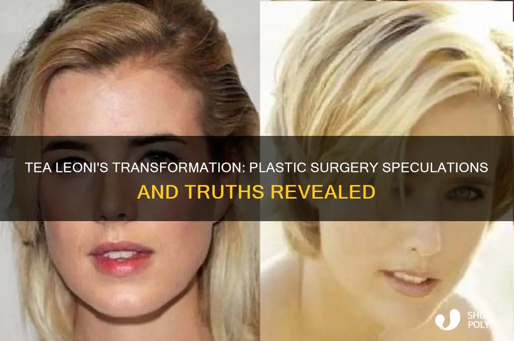 has tea leoni had plastic surgery