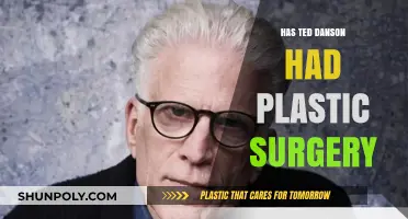 Has Ted Danson Had Plastic Surgery? Uncovering the Truth