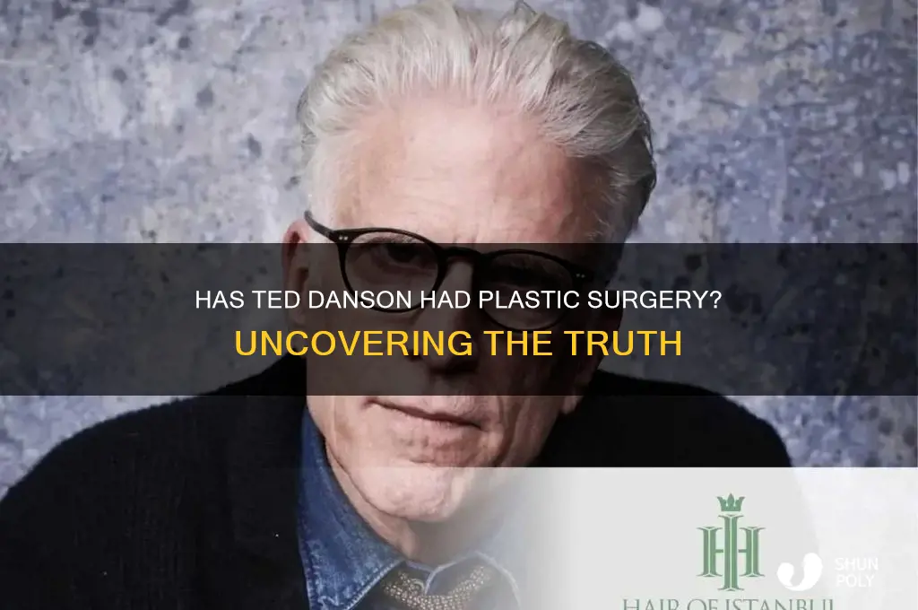 has ted danson had plastic surgery