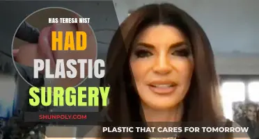 Teresa Giudice's Transformation: Plastic Surgery Speculations and Rumors Explored