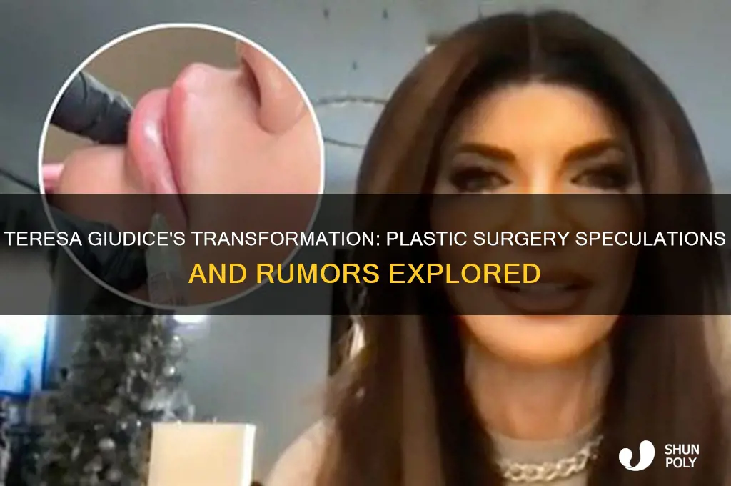 has teresa nist had plastic surgery
