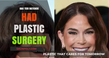 Has Teri Hatcher Had Plastic Surgery? Uncovering the Truth