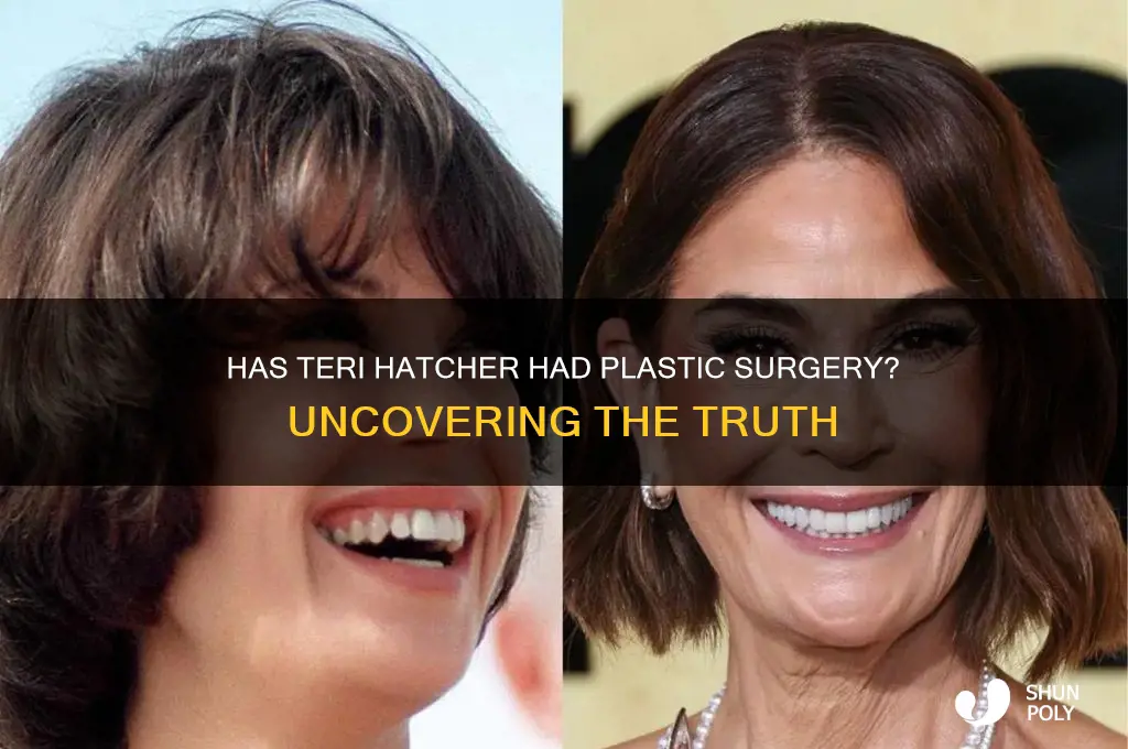 has teri hatcher had plastic surgery