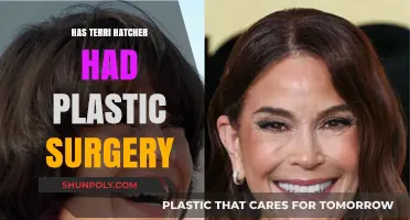Terri Hatcher's Transformation: Plastic Surgery Rumors and Reality Revealed