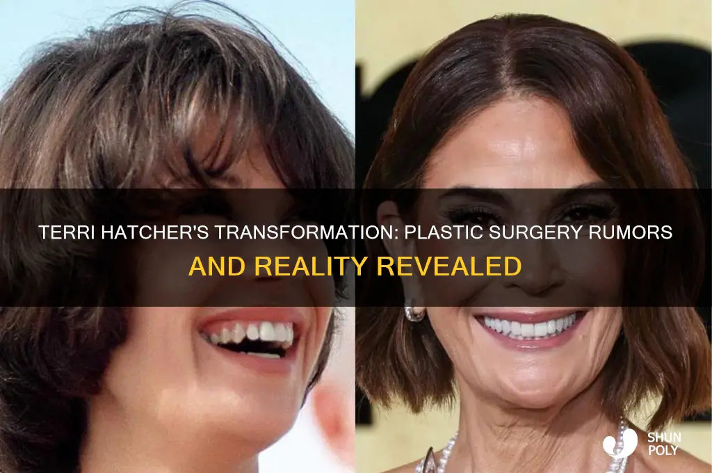 has terri hatcher had plastic surgery
